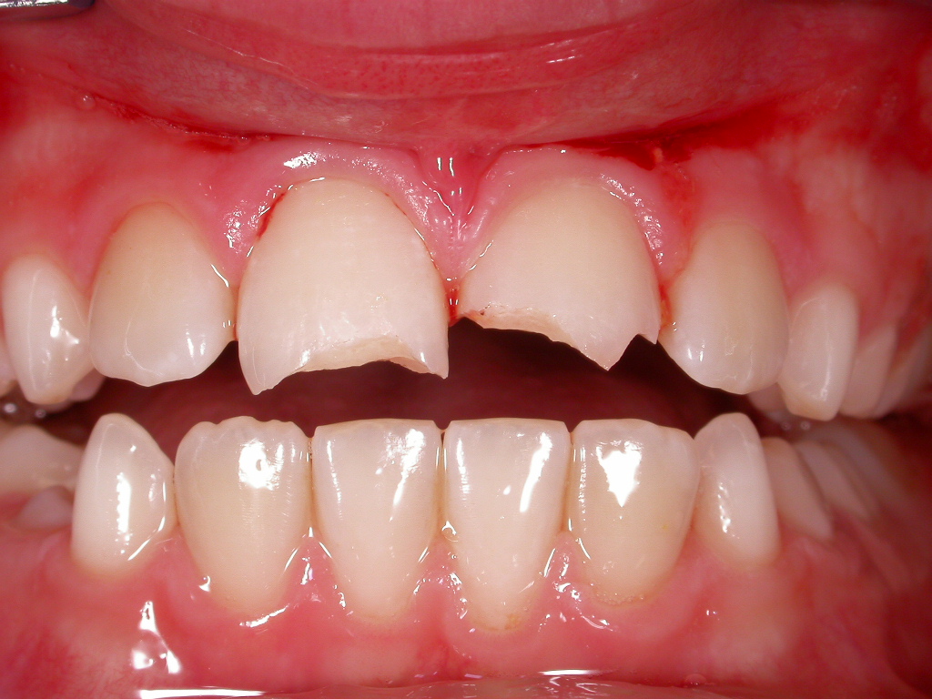 Situation nach Sturz